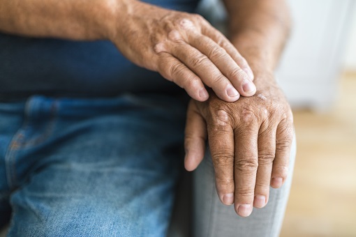 preventing-skin-problems-in-seniors